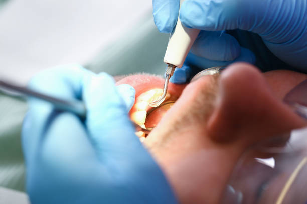 Best Root Canal Emergency Dentist  in Courtland, VA